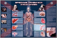 Электрифицированный стенд "Вредные привычки: алкоголизм" - «globural.ru» - Йошкар-Ола