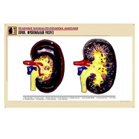 Рельефная таблица "Почка. Фронтальный разрез" (формат А1, матовое ламинир.) - «globural.ru» - Йошкар-Ола